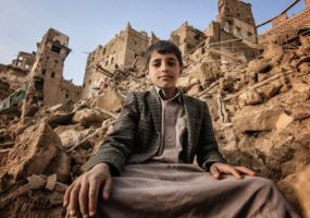 النزاع في اليمن: العيون لا تكذب أبدًا