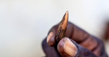 Tchad : des dizaines de blessés lourds venus du Soudan pris en charge par l’antenne chirurgicale du CICR