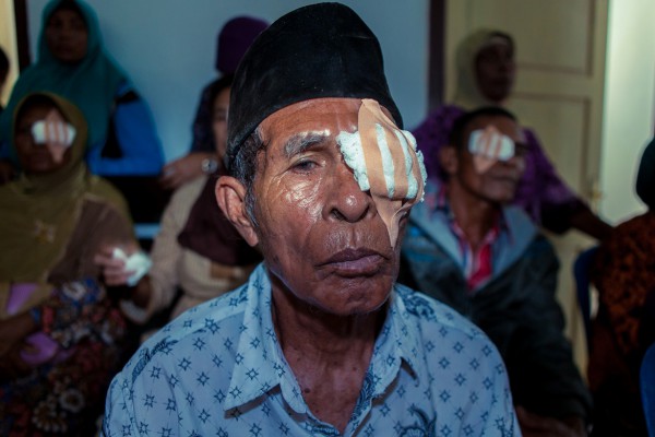 חולה מחכה לביקורת אצל רופא עיניים, יום אחרי ניתוח הקטרקט שעבר בעינו השמאלית.