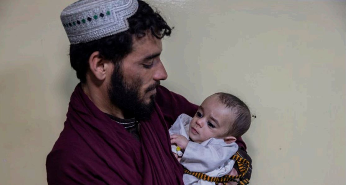 Afghanistan : recrudescence des cas de pneumonie et de malnutrition infantiles