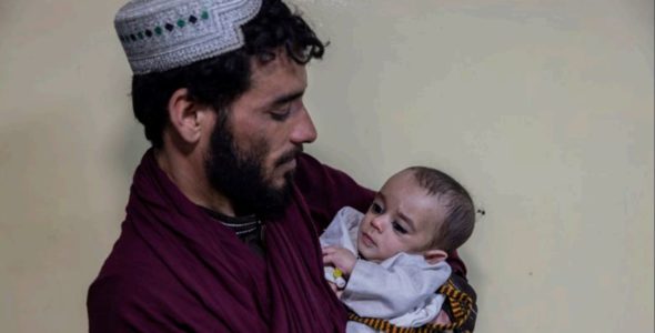 Afghanistan : recrudescence des cas de pneumonie et de malnutrition infantiles