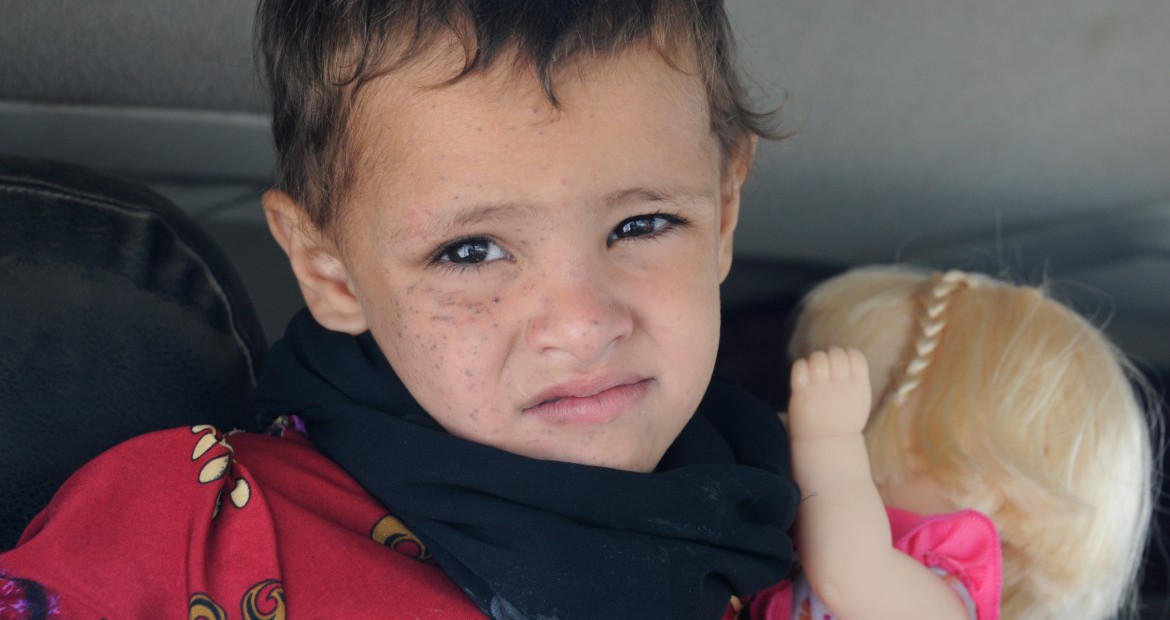 Yemen: Three-year-old Hayat walks out of rehabilitation centre