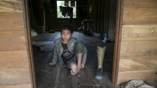 Laos, Provinsi Savannakhet, desa Tomlaung. Seorang anak laki-laki korban ranjau darat. © Getty Images/CICR/Paula Bronstein