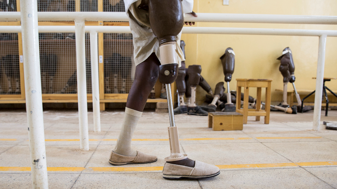 Replacing Lost Limbs: Physically, Mentally, Virtually