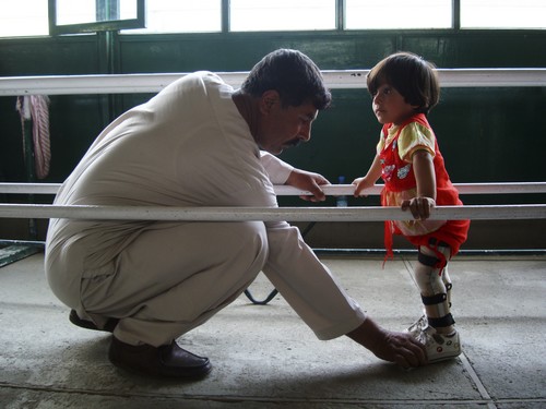 เจ้าหน้าที่ของศูนย์ฟื้นฟูทางกายภาพของไอซีอาร์ซีในกรุงคาบูล อัฟกานิสถานกำลังฝึกการเดินให้กับผู้ป่วยตัวน้อย